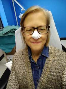 Me after Mohs round 1